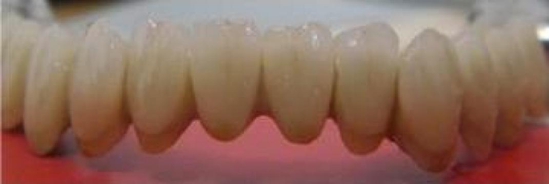 Ceramica pe zirconiu de la Dentaltech
