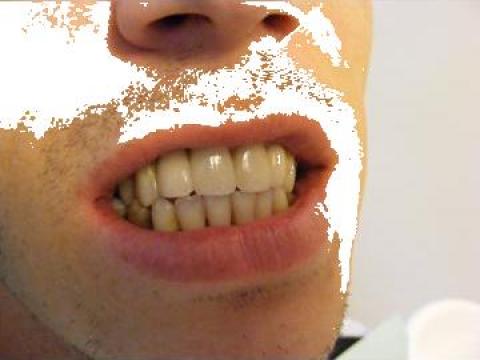 Laborator de tehnica dentara