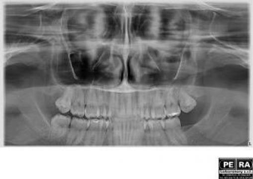 Radiografie de sinusuri maxilare de la Petra Laboratory - Centrul De Radiologie Digitala Stomatolog
