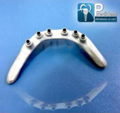 Structuri metalice dentare sinterizate laser de la Precident SRL