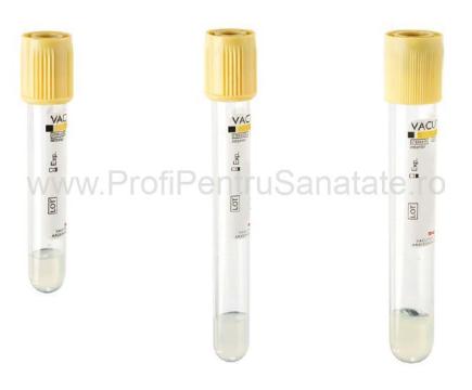 Eprubeta Vacutest Kima - biochimie cu clot activator de la Profi Pentru Sanatate Srl